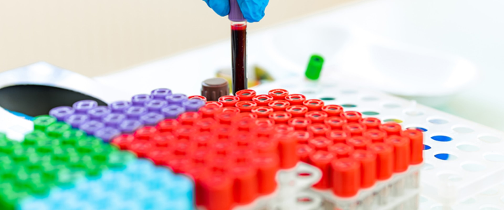 Glycated Hemoglobin Test (HbA1c): What You Need to Know