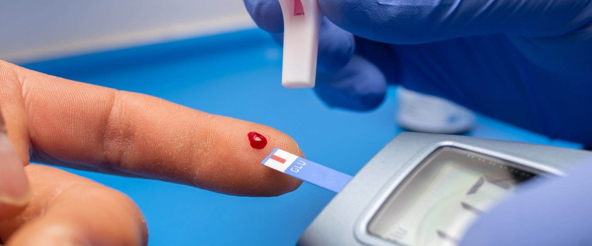 Fingerprick Tests Understanding Normal Blood Glucose Levels