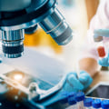 Glycated Hemoglobin Test (HbA1c): A Comprehensive Overview
