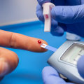 Finger-prick Tests: Understanding Normal Blood Glucose Levels