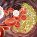 The Comprehensive Overview of Cardiovascular Disease