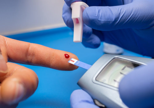 Finger-prick Tests: Understanding Normal Blood Glucose Levels