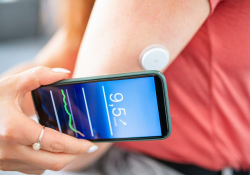 Types of Smartphone-based Glucose Monitoring Systems