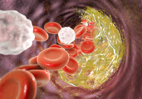 The Comprehensive Overview of Cardiovascular Disease